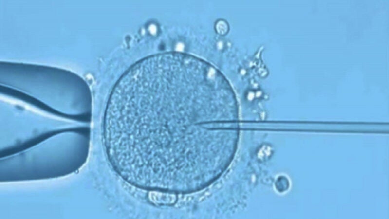 Los ovarios: trastornos benignos y malignos