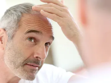 El trasplante capilar El trasplante capilar