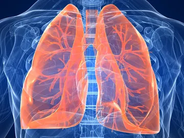 La fibrosis pulmonar La fibrosis pulmonar