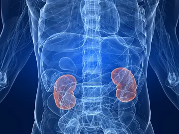 Piedras en el riñón Piedras en el riñón