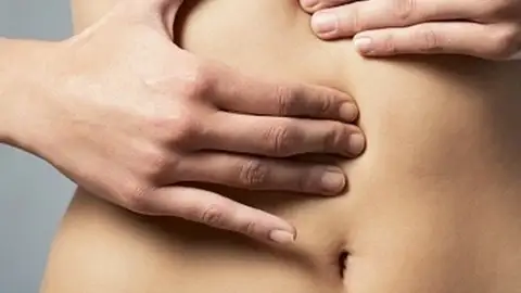 cáncer de colon cáncer de colon