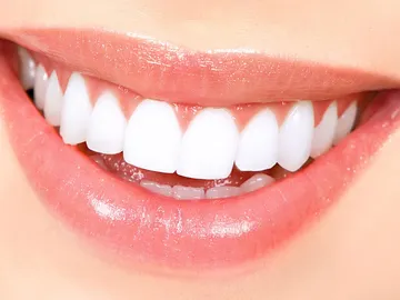 Imagen de la sonrisa de una mujer Imagen de la sonrisa de una mujer