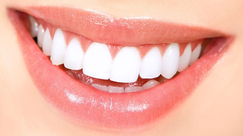 Presume de sonrisa