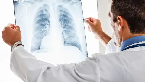 Neumología Neumología