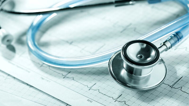 Vivir con una arritmia