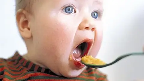 Alimentación del bebé ¿Qué me pasa doctor?