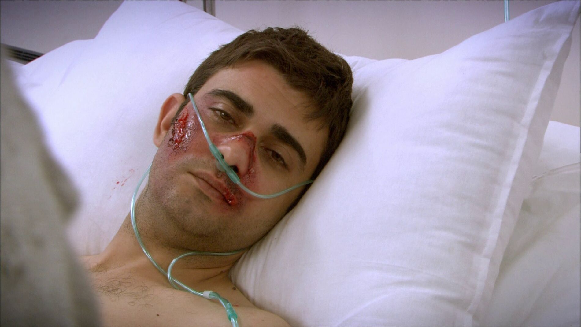 Mehmet, ingresado en el hospital tras recibir una paliza