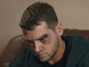 Murat, golpeado Murat, golpeado