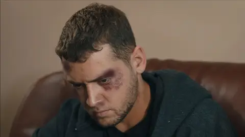 Murat, golpeado Fugitiva