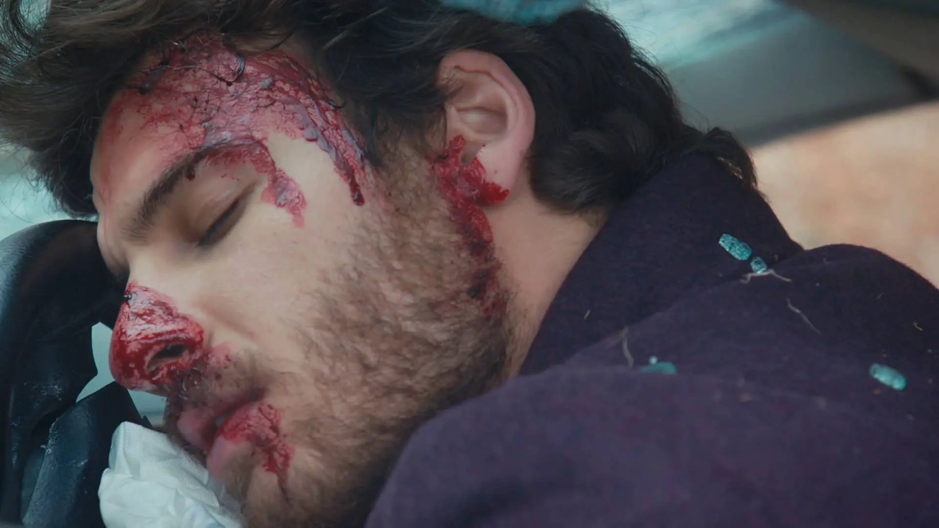 Así es como Ömer da con el paradero de Defne, pero en su huida, sufren un aparatoso accidente de tráfico provocado por Adnan Así es como Ömer da con el paradero de Defne, pero en su huida, sufren un aparatoso accidente de tráfico provocado por Adnan