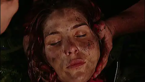 Dínora, en peligro tras sufrir una mordedura en el pantano Dínora, en peligro tras sufrir una mordedura en el pantano