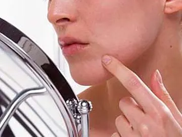 Acaba con el acné Acaba con el acné