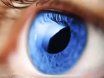 El glaucoma El glaucoma