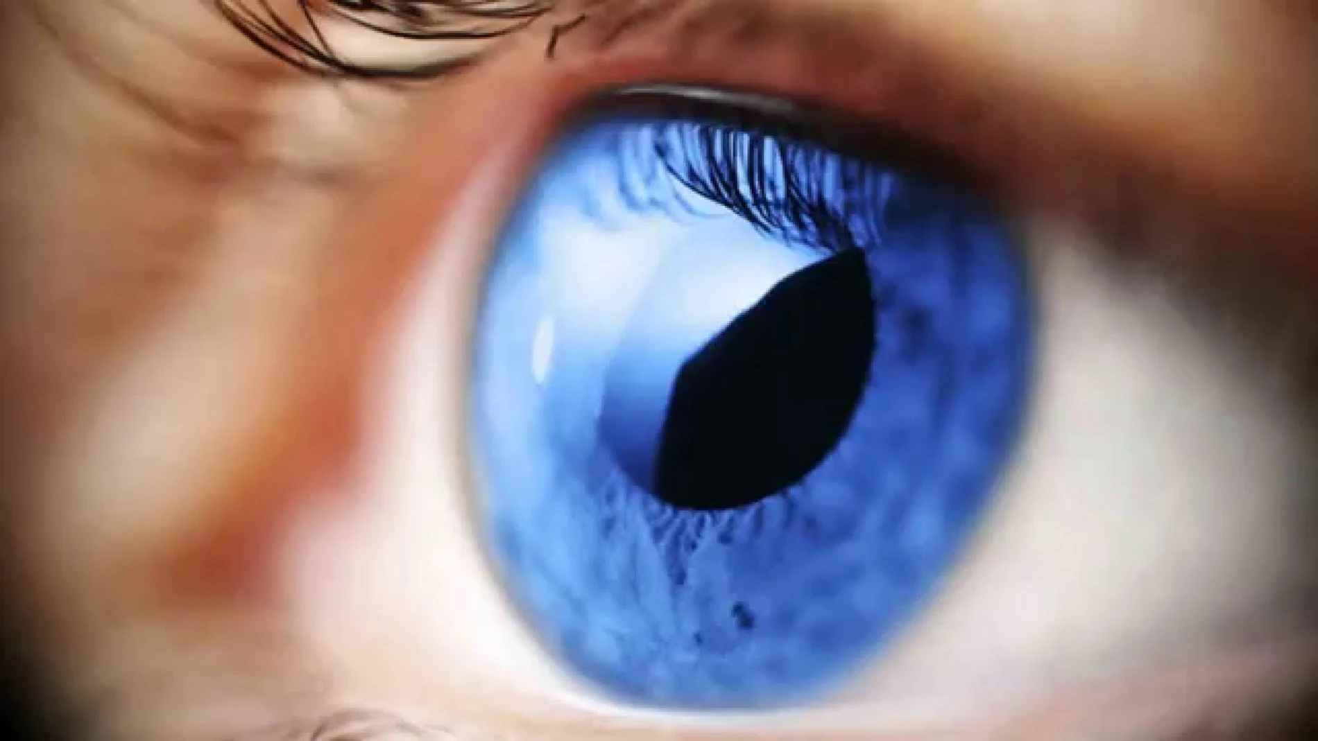 El glaucoma: la ceguera silenciosa