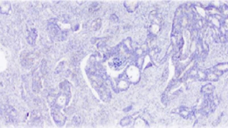 Este fin de semana, en ¿Qué me pasa doctor?, hablaremos de podología y de oncología