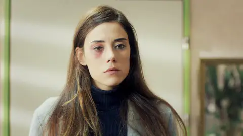 Zeynep se autolesiona para fingir que es víctima de violencia de género Madre