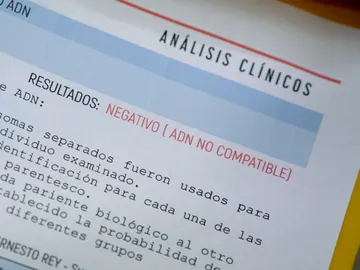 Los análisis de Ernesto Rey Los análisis de Ernesto Rey